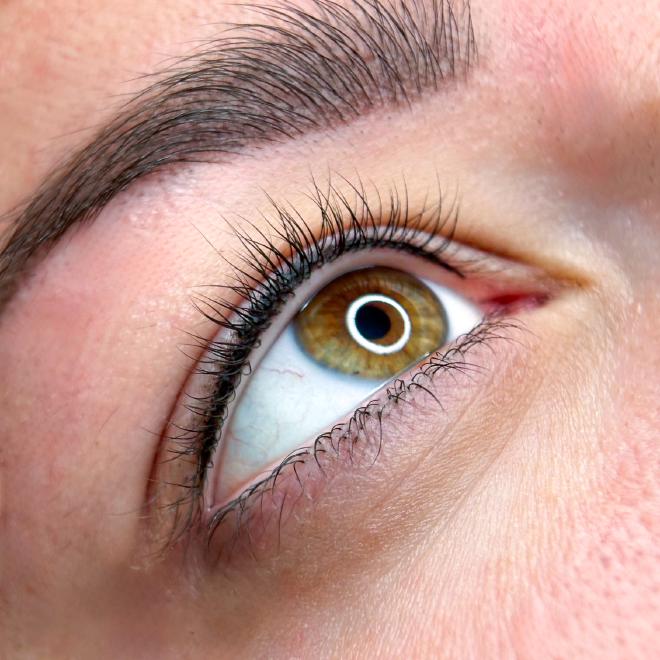 Wimpernkranzverdichtung